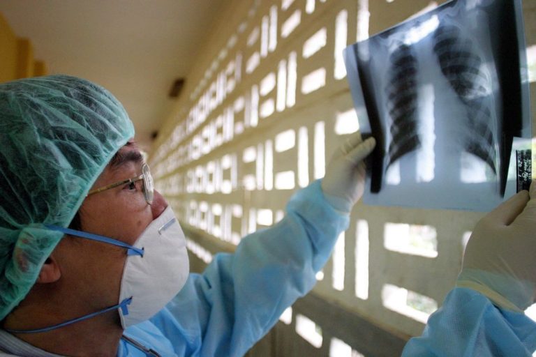 Tempo de sobrevivência no cancro do pulmão duplica com novos tratamentos