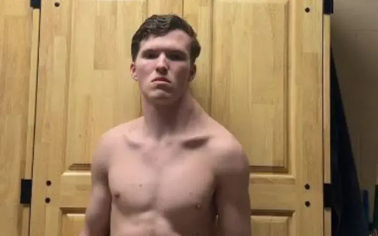 O Homem Torto – Influencer de 19 anos viraliza ao treinar apenas um lado do corpo (VÍDEO)
