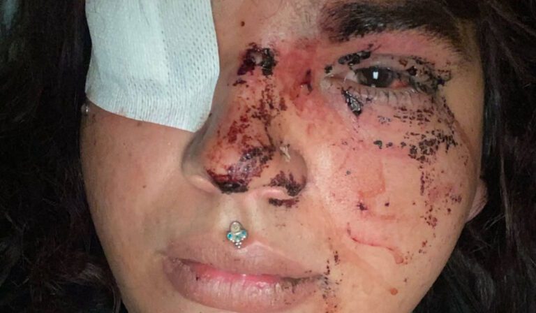 Cinco detidas por agressão brutal a Bianca, candidata a Miss Trans Espanha