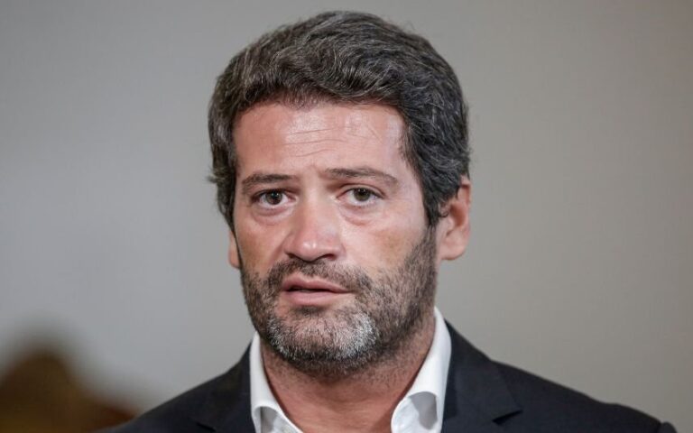 André Ventura Surge com olho negro e há quem suspeite de agressão ou culto satânico. Entenda!