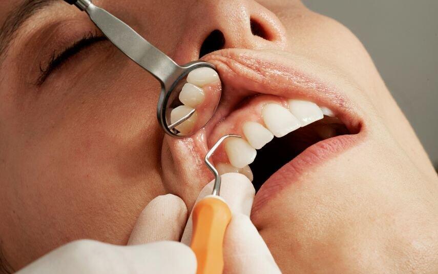 Signos Atenção! Este signo deve fazer uma visita ao dentista…