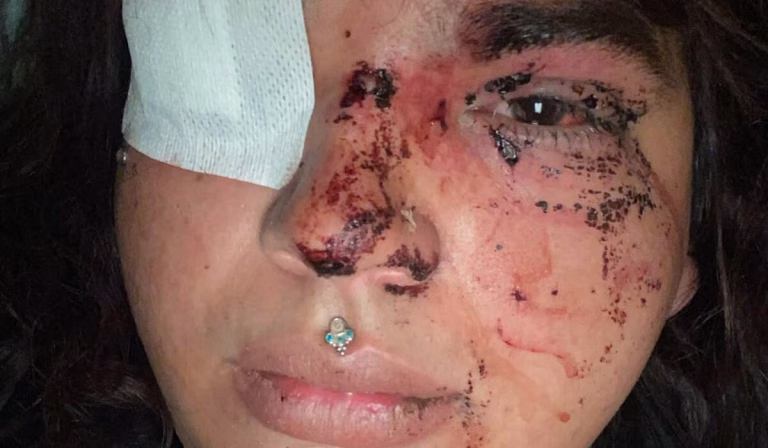 Cinco detidas por agressão brutal a Bianca, candidata a Miss Trans Espanha